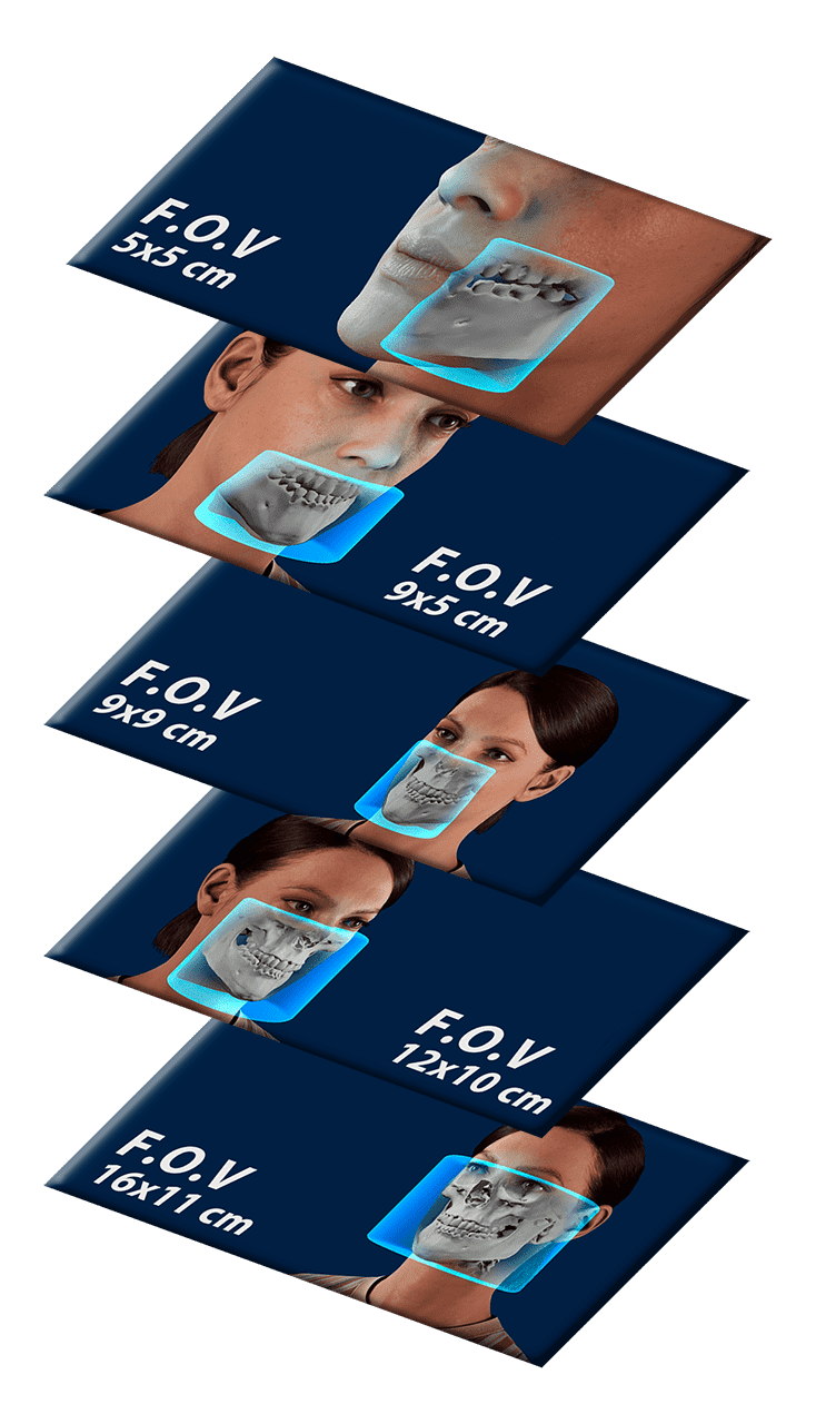 Multi-FOV Field of View visualization