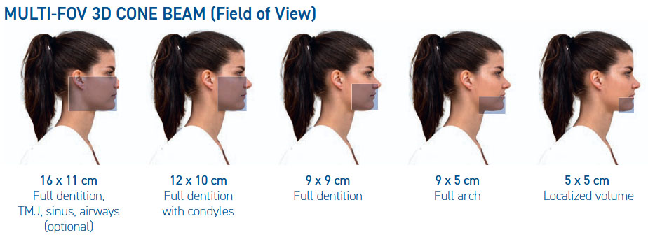 Multi‑FOV illustration