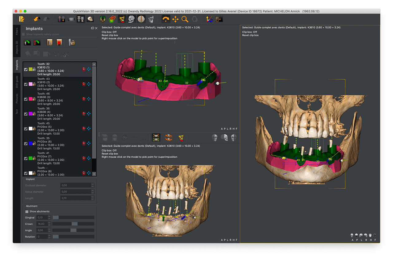 QuickVision 3D interface