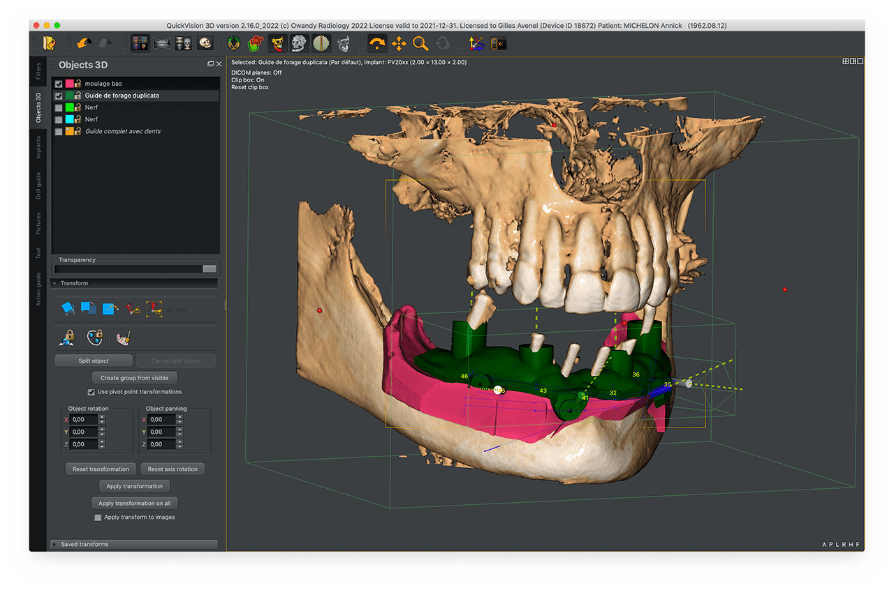 QuickVision 3D 3D visualization